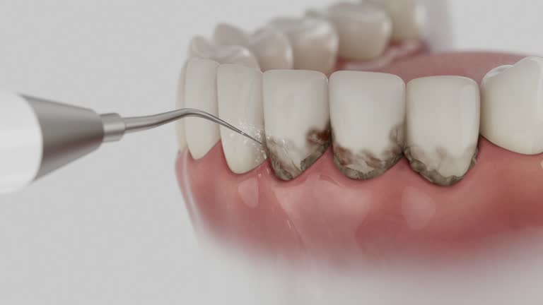Trusted Wisdom Tooth Removal service in Rothsville, PA - Dentist Open Now